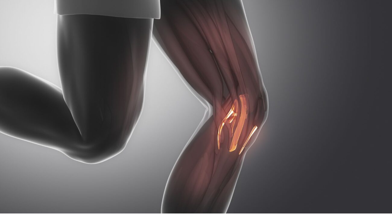Giãn dây chằng đầu gối là gì? Cách phục hồi giãn dây chằng hiệu quả